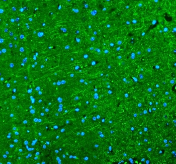 Immunofluorescent staining of FFPE mouse brain tissue with Alpha Internexin antibody (green) and DAPI nuclear stain (blue). HIER: steam section in pH8 EDTA buffer for 20 min.