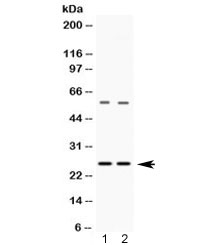 Western blot testing of 1) rat liver and 2) HeLa lysate with VAMP7 antibody at 0.5ug/ml. Expected molecular weight ~25 kDa.