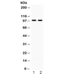 Western blot testing of 1) rat brain and 2) mouse brain lysate with ABR antibody at 0.5ug/ml. Predicted molecular weight ~98 kDa.