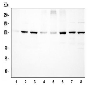 Western blot testing of 1) rat skeletal muscle, 2) rat liver, 3) rat lung, 4) rat RH35, 5) mouse skeletal muscle, 6) mouse liver, 7) mouse lung and 8) mouse NIH 3T3 cell lysate with ACTN4 antibody at 0.5ug/ml. Predicted molecular weight ~105 kDa.