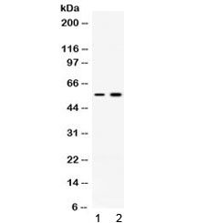 Western blot testing of 1) rat skeletal muscle and 2) human MCF7 lysate with ACVR2B antibody at 0.5ug/ml. Expected molecular weight ~57 kDa.