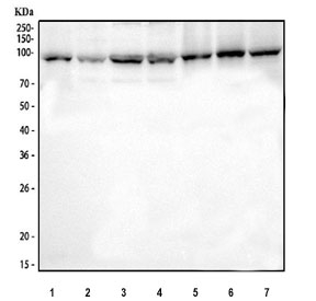 Western blot testing of 1) human Jurkat, 2) human 293T, 3) human K562, 4) human MCF7, 5) rat lung, 6) rat pancreas and 7) mouse pancreas tissue lysate with AGO2 antibody at 0.5ug/ml. Expected molecular weight ~97 kDa.