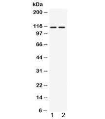 Western blot testing of 1) rat thymus and 2) human 22RV1 lysate with AGO4 antibody at 0.5ug/ml. Predicted molecular weight ~97 kDa, observed here at ~115 kDa.