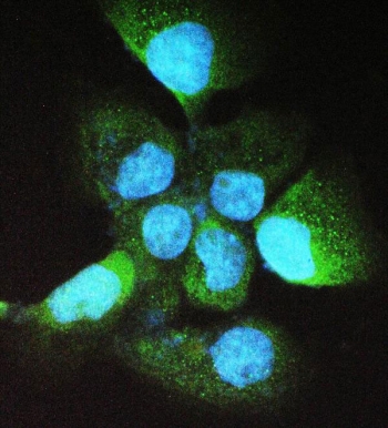 Immunofluorescent staining of FFPE human A431 cells with ADH5 antibody. HIER: boil tissue sections in pH6, 10mM citrate buffer, for 20 min and allow to cool before testing.