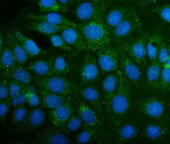 Immunofluorescent staining of FFPE human MCF7 cells with ABAT antibody (green) and DAPI nuclear stain (blue). HIER: steam section in pH6 citrate buffer for 20 min.