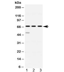 Western blot testing of 1) rat spleen, 2) mouse thymus and 3 human HeLa lysate with ABCE1 antibody at 0.5ug/ml. Predicted molecular weight ~67 kDa.