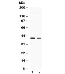 Western blot testing of 1) rat kidney and 2) human A431 lysate with ABHD5 antibody at 0.5ug/ml. Predicted molecular weight ~39 kDa.