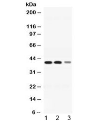 Western blot testing of 1) rat liver, 2) mouse liver and 3) HepG2 lysate with ADH4 antibody at 0.5ug/ml. Predicted molecular weight ~40 kDa.