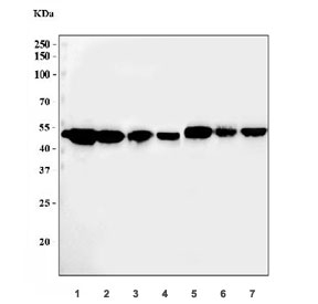 Western blot testing of human MCF7 cell lysate with ADK antibody at 0.5ug/ml. Predicted molecular weight ~40 kDa.