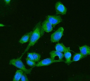 Immunofluorescent staining of FFPE human U-2 OS cells with AK1 antibody (green) and DAPI nuclear stain (blue). HIER: steam section in pH6 citrate buffer for 20 min.