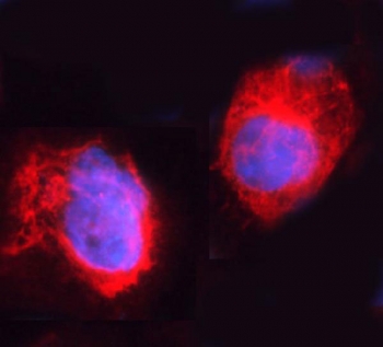 Immunofluorescent staining of FFPE human A431 cells with ARHGEF1 antibody (red) and DAPI nuclear stain (blue). HIER: steam section in pH6 citrate buffer for 20 min.