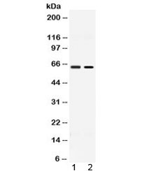 Western blot testing of 1) rat testis and 2) human MCF7 lysate with ACCN1 antibody at 0.5ug/ml. Predicted molecular weight ~58 kDa.
