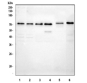 Western blot testing of 1) human HaCaT, 2) human A431, 3) human A549, 4) human MCF7, 5) rat C6 and 6) mouse Neuro-2a cell lysate with BDKRB2 antibody at 0.5ug/ml. Predicted molecular weight ~44 kDa but may be observed at higher molecular weights due to glycosylation.