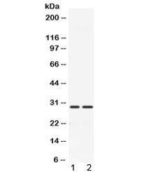 Western blot testing of 1) rat muscle and 2) mouse muscle with CA3 antibody at 0.5ug/ml. Predicted/observed molecular weight ~29 kDa.