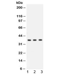 Western blot testing of human 1) COLO320, 2) MCF7 and 3) U-2 OS lysate with Cathepsin G antibody at 0.5ug/ml. Predicted molecular weight ~29 kDa, can be observed at ~36 kDa.