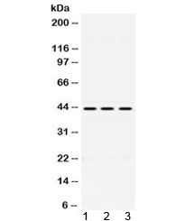 Western blot testing of 1) rat liver, 2) mouse spleen and 3) human HepG2 lysate with DHODH antibody at 0.5ug/ml. Predicted/observed molecular weight ~43 kDa.