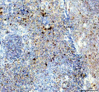 IHC staining of FFPE mouse spleen tissue with TCP1 antibody, HRP-labeled secondary and DAB substrate. HIER: boil tissue sections in pH8 EDTA for 20 min and allow to cool before testing.