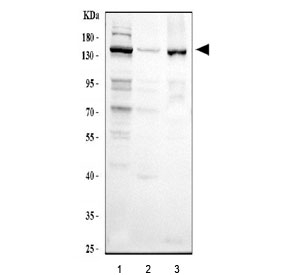 Western blot testing of human 1) HeLa, 2) A431 and 3) SiHa cell lysate with CSB antibody at 0.5ug/ml. Predicted/observed molecular weight: ~168 kDa.