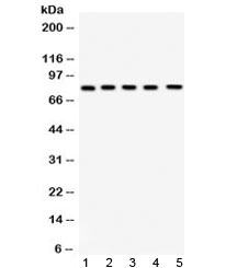 Western blot testing of 1) rat testis, 2) rat ovary, 3) mouse testis, 4) mouse ovary and 5) human HeLa lysate with FSH Receptor antibody at 0.5ug/ml. Predicted/observed molecular weight: ~78 kDa.