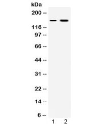 Western blot testing of 1) rat kidney and 2) human HepG2 lysate with Insulin Receptor antibody at 0.5ug/ml. Predicted/observed molecular weight: ~156 kDa.