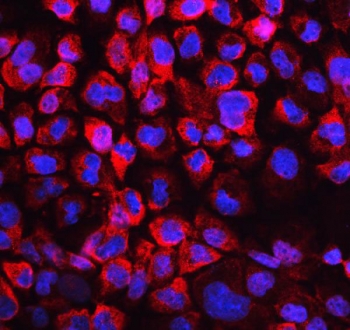 Immunofluorescent staining of human A431 cells with LDHB antibody (red) and DAPI nuclear stain (blue).