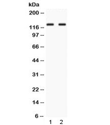 Western blot testing of 1) rat testis and 2) human HepG2 lysate with LRIG3 antibody at 0.5ug/ml.  Observed molecular weight: ~123 kDa (precursor), 140-170 kDa (glycosylated).