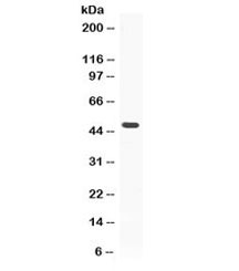 Western blot testing of human MCF7 lysate with ADRP antibody at 0.5ug/ml.  Predicted/observed molecular weight ~48 kDa.