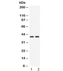 Western blot testing of 1) rat pancreas and 2) human HeLa lysate with PSAT1 antibody at 0.5ug/ml. Predicted/observed molecular weight ~40 kDa.