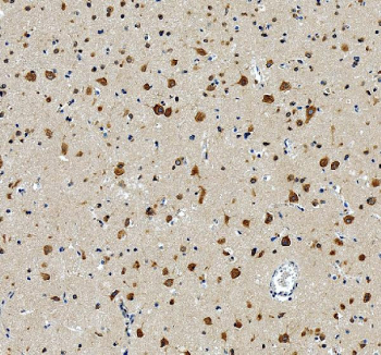 IHC staining of FFPE human brain tissue with RPL19 antibody, HRP-secondary and DAB substrate. HIER: boil tissue sections in pH8 EDTA for 20 min and allow to cool before testing.
