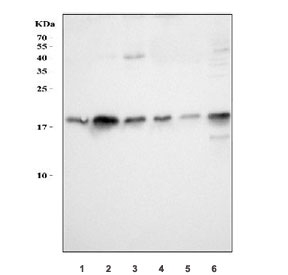 Western blot testing of 1) rat liver, 2) rat spleen, 3) rat stomach, 4) rat RH35, 5) mouse liver and 6) mouse spleen tissue lysate with PC4 antibody. Expected molecular weight: 15-19 kDa (unmodified) and ~26 kDa (phosphorylated).
