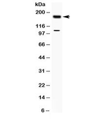 Western blot testing of human MCF7 cell lysate with TIAM1 antibody at 0.5ug/ml. Predicted/observed molecular weight ~178 kDa.