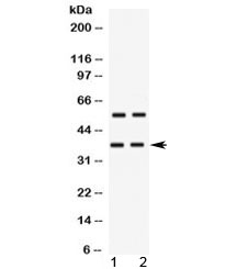 Western blot testing of human 1) HeLa and 2) MCF7 cell lysate with TREX2 antibody at 0.5ug/ml. Predicted molecular weight ~31/26 kDa (isoforms 1/2), observed here at ~37 kDa.
