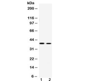 Western blot testing of human 1) U-2 OS and 2) SW620 cell lysate with ATF4 antibody at 0.5ug/ml. Predicted molecular weight ~39 kDa.