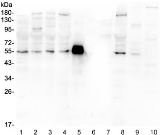 Western blot testing of human 1) PC-3, 2) U-2 OS, 3) A549, 4) HEK293, 5) rabbit IgG, 6) marker, 7) human MDA-MB-453, 8) monkey COS-7, 9) rat lung and 10) mouse lung lysate with MMP13 antibody at 0.5ug/ml. Predicted molecular weight ~54 kDa.
