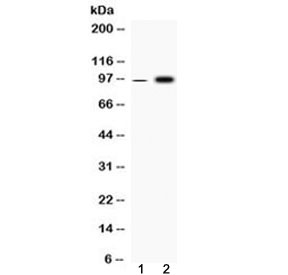 Western blot testing of 1) rat skeletal muscle and 2) human HepG2 cell lysate with Fibrinogen alpha chain antibody at 0.5ug/ml. Predicted molecular weight ~95 kDa (alpha-E isoform).