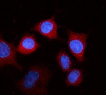 Western blot testing of 1) rat kidney, 2) mouse liver and 3) human HeLa lysate with Fibrinogen beta chain antibody at 0.5ug/ml. Predicted molecular weight ~56 kDa.