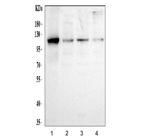 Western blot testing of human 1) U-87 MG, 2) HEL, 3) HepG2 and 4) RT4 cell lysate with Hexokinase II antibody at 0.5ug/ml.  Predicted molecular weight ~102 kDa.