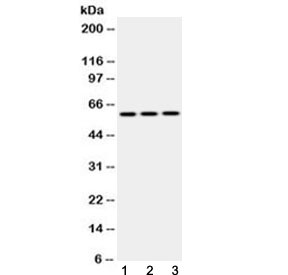 Western blot testing of 1) rat brain, 2) mouse NIH3T3 and 3) human HepG2 lysate with Cytokeratin 14 antibody at 0.5ug/ml. Predicted molecular weight ~53 kDa.
