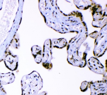 IHC staining of FFPE human placental tissue with AFF4 antibody. HIER: boil tissue sections in pH8 EDTA for 20 min and allow to cool before testing.