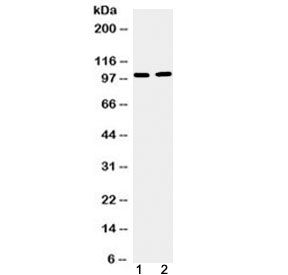 Western blot testing of 1) mouse testis and 2) human U-87 MG cell lysate with TACC1 antibody at 0.5ug/ml. Predicted molecular weight ~88 kDa but routinely observed at 100-125 kDa.
