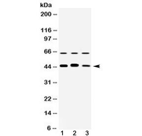 Western blot testing of 1) rat brain, 2) mouse brain and 3 human HeLa cell lysate with ARFGAP1 antibody at 0.5ug/ml. Predicted molecular weight ~45 kDa.