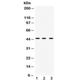 Western blot testing of 1) rat liver, 2) mouse spleen and 3) human HeLa cell lysate with hnRNP F antibody at 0.5ug/ml.  Predicted molecular weight ~46 kDa.