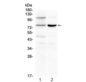 Western blot testing of 1) rat liver and 2) mouse kidney lysate with Dishevelled 2 antibody at 0.5ug/ml. Predicted molecular weight ~79 kDa, can be observed at 90-95 kDa.