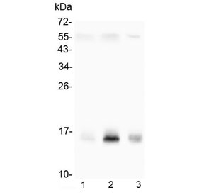 Western blot testing of 1) rat PC-12, 2) human K562 and 3) mouse thymus cell lysate with Survivin antibody at 0.5ug/ml. Predicted molecular weight ~16 kDa.