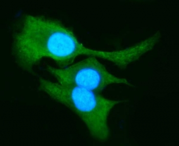 Immunofluorescent staining of FFPE human A549 cells with AKR1B10 antibody (green) and DAPI nuclear stain (blue). HIER: steam section in pH6 citrate buffer for 20 min.