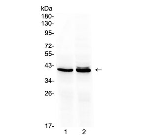 Western blot testing of 1) rat liver and 2) mouse liver lysate with OTC antibody at 0.5ug/ml. Predicted molecular weight ~40 kDa.