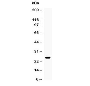 Western blot testing of mouse thymus tissue with TNF alpha antibody at 0.5ug/ml. Predicted molecular weight ~26 kDa.