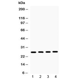 Western blot testing of 1) rat brain, 2) mouse ovary, 3) human 22RV1 and 4) human HeLa lysate with HMGB1 antibody at 0.5ug/ml. Predicted molecular weight ~25 kDa.