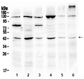 Western blot testing of 1) rat brain, 2) rat testis, 3) mouse brain, 4) mouse testis, 5) human U-2 OS and 6) human HepG2 lysate with SPARC antibody at 0.5ug/ml. Predicted molecular weight ~35 kDa, routinely observed at ~43 and 50 kDa.