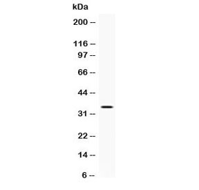 Western blot testing of human A431 cell lysate with NAT1 antibody at 0.5ug/ml. Predicted molecular weight ~34 kDa.